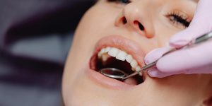 Clareamento dental