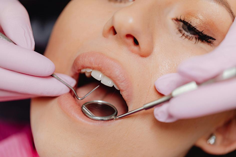 Clareamento Dental