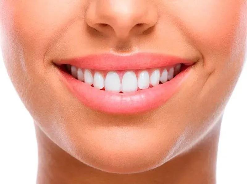 Clarear Dentes