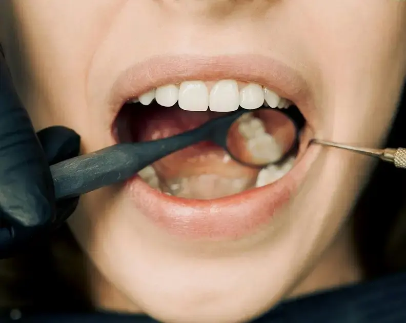 Como Aliviar a Dor de Dente em Casa