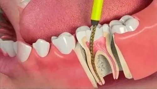 Emergência Dental
