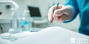 Higiene Dentista: Recall de Pacientes Expõe Riscos