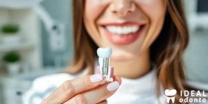 Implante Dentário: Como Funciona e Benefícios