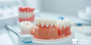 Tipos de Coroa Dentária: Descubra as Opções e Benefícios