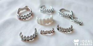5 Tipos de Braquetes e Suas Vantagens