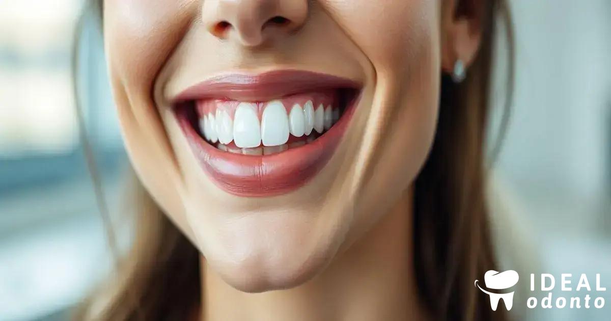 Benefícios Estéticos do Implante Dentário