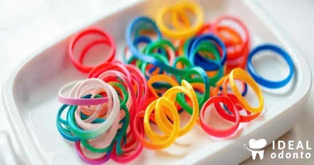 Como Escolher as Melhores Cores de Borrachinha para Aparelho?