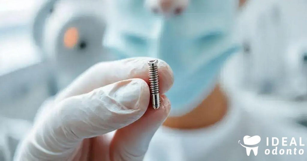Mini Implante Dentário: Descubra Como Funciona e Suas Vantagens