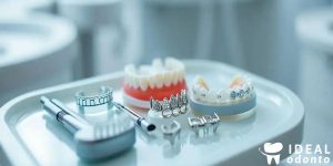 Técnica Bidimensional: Vantagens e Aplicações na Ortodontia