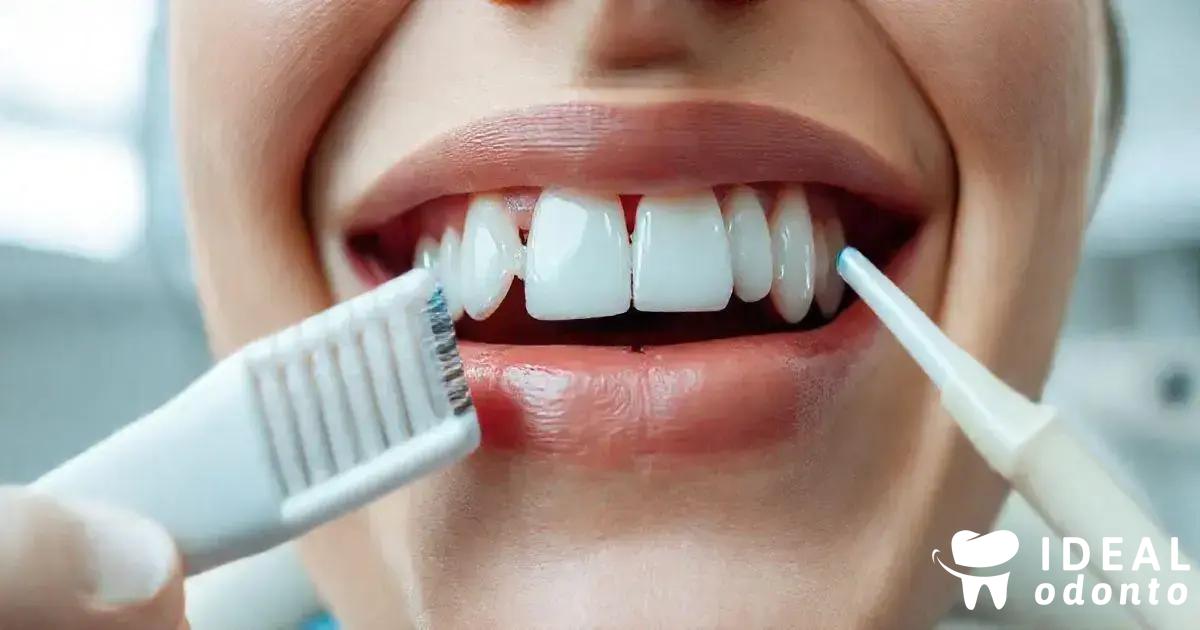 Tratamentos Disponíveis para Doenças Gengivais