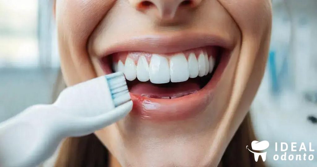 Tudo sobre Aplicação de Flúor: Benefícios e Cuidados