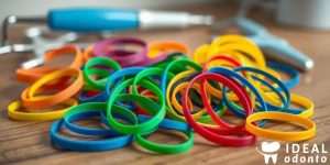 Borrachinha do Aparelho: 5 Fatos Importantes que Você Precisa Saber