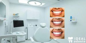 10 Técnicas de Clareamento Dental que Você Precisa Conhecer