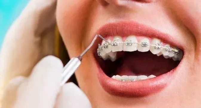 Melhor plano dentário do brasil