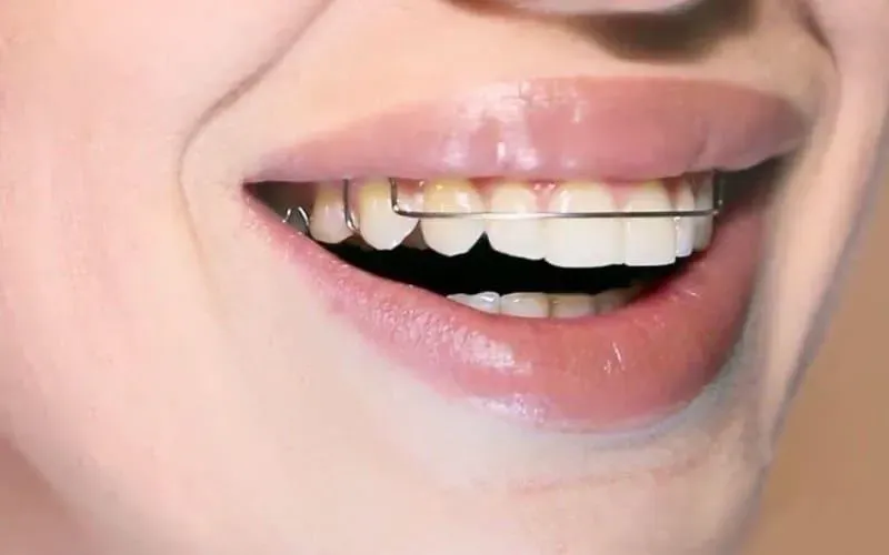 Plano odontológico ortodontia